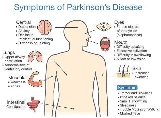 Experts say the first warning sign of the disease, which causes muscle stiffness, tremors and balance problems, could actually be altered speech