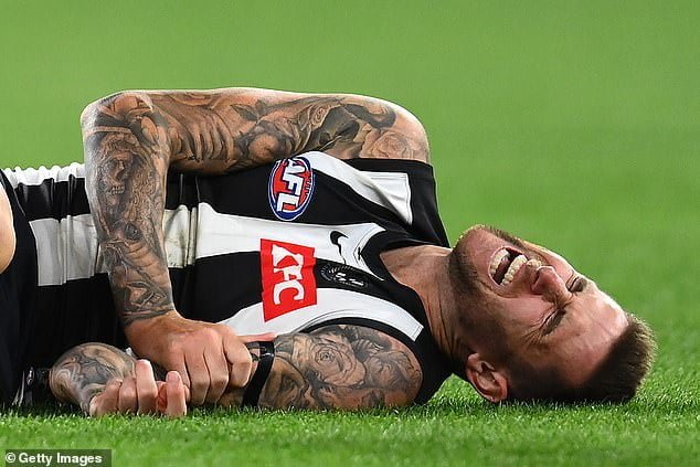 Collingwood star Jeremy Howe has opened up on the ordeal of his brutal arm injury