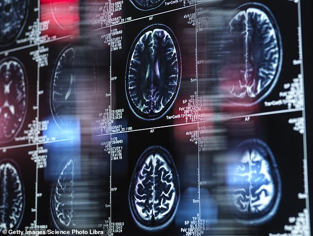 The study looked at people over 65 who were hospitalized with COVID-19 in 2020. This means their study population was very sick, and its difficult to say how people with less severe illness might be affected