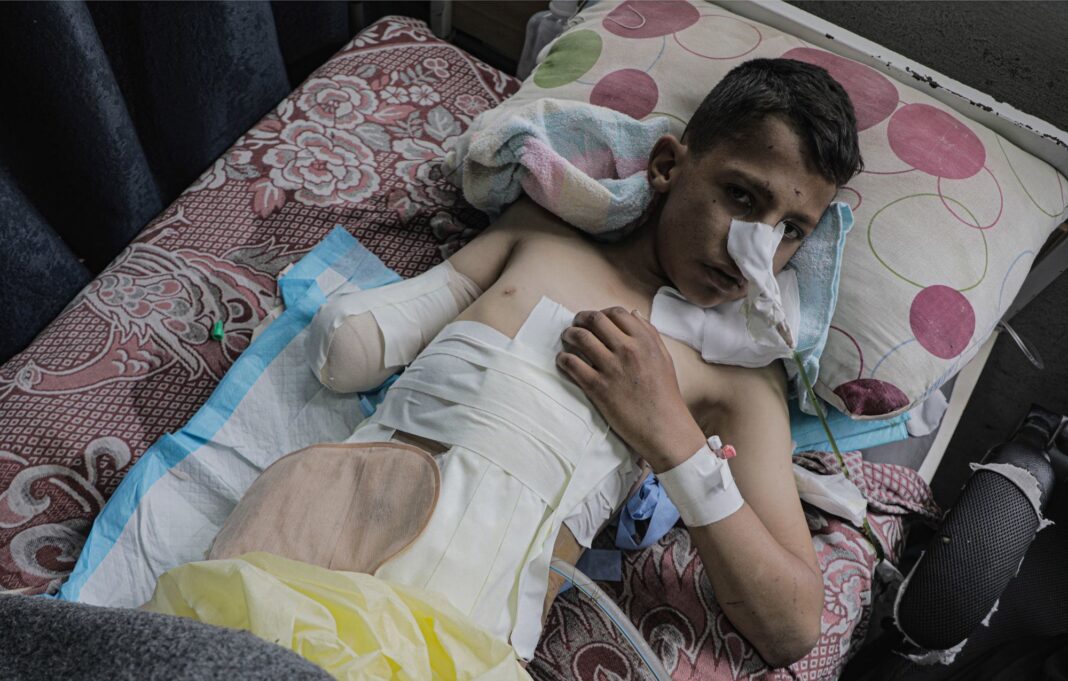 A boy receives medical care after being caught in a missile attack in Gaza.